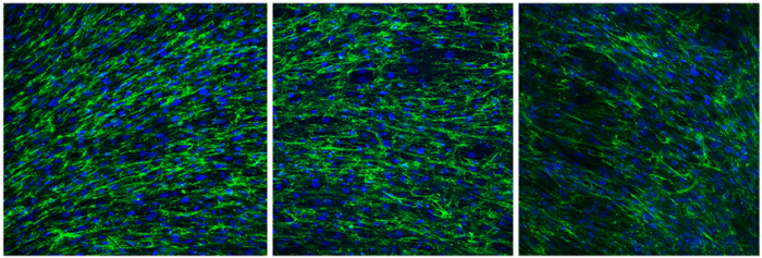 fibroblasts 2019